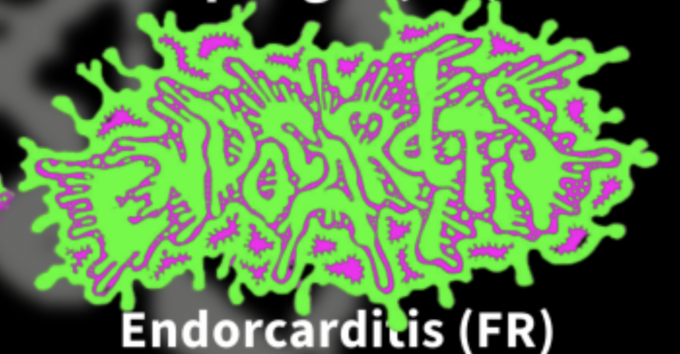 Endocarditis